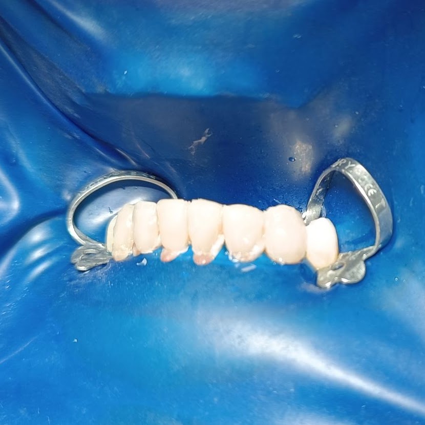 Ricostruzioni Estetiche